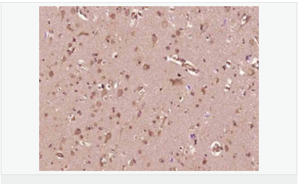 6052ae0a2d0ed.png image.png