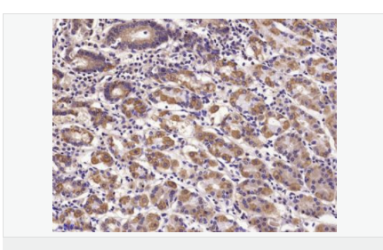 605830e698abf.png image.png