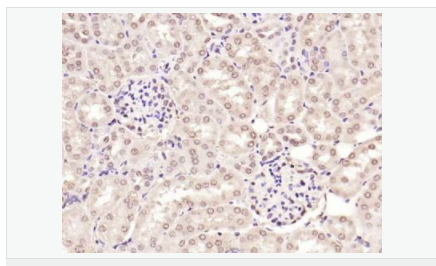 605841cb61a10.png image.png