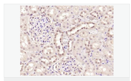 605841d7c9442.png image.png