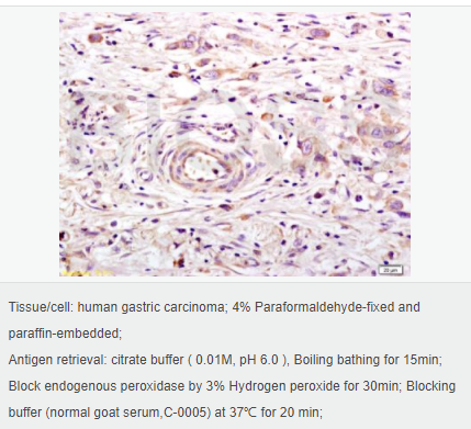 60594e91197eb.png image.png