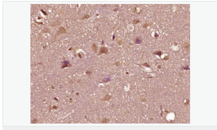 605958bbef70a.png image.png