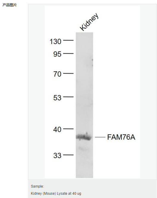 60595f49c9f5e.png image.png