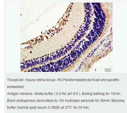 6076420dc422c.png image.png